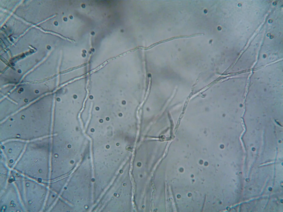 Una vista al microscopio de varias esporas de moho aerotransportadas.